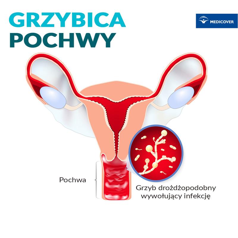 Sygnały alarmowe infekcji