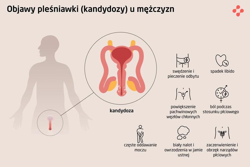 Jak skutecznie radzić sobie z grzybicą odbytu? Praktyczne porady oraz metody leczenia
