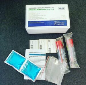 Kluczowe markery jelitowe w diagnostyce: odkryj, co mówią o naszym zdrowiu