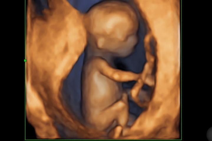 Badania przed ciążą po 30. roku życia