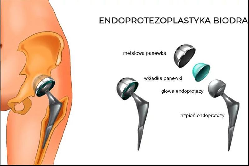 Badania przedoperacyjne i diagnostyka