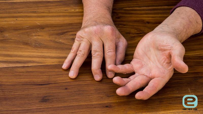 Dieta a stany zapalne