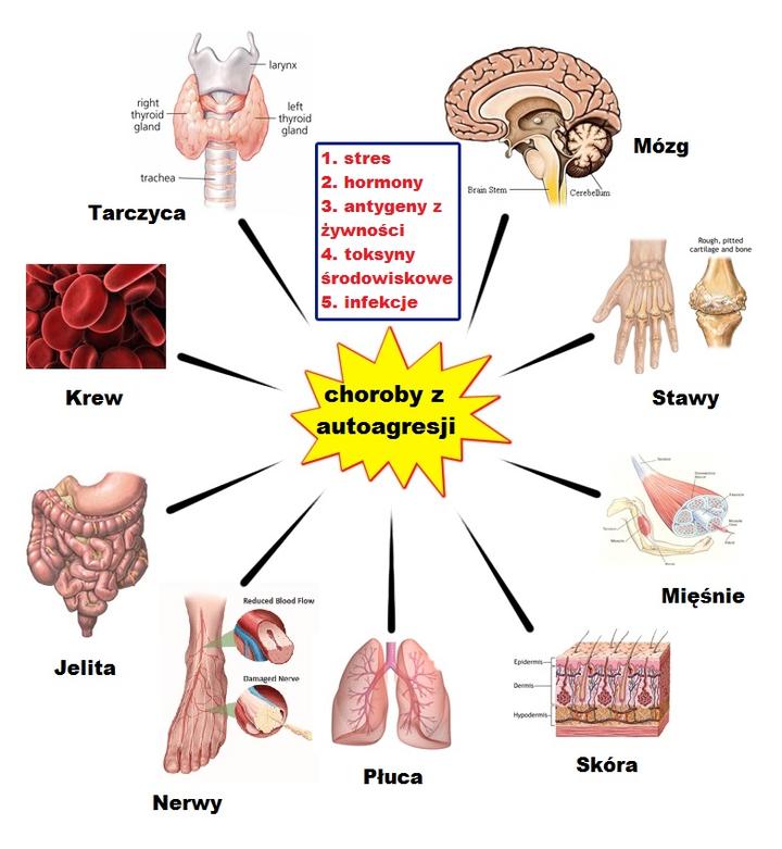 Najczęstsze schorzenia dermatologiczne o podłożu autoimmunologicznym
