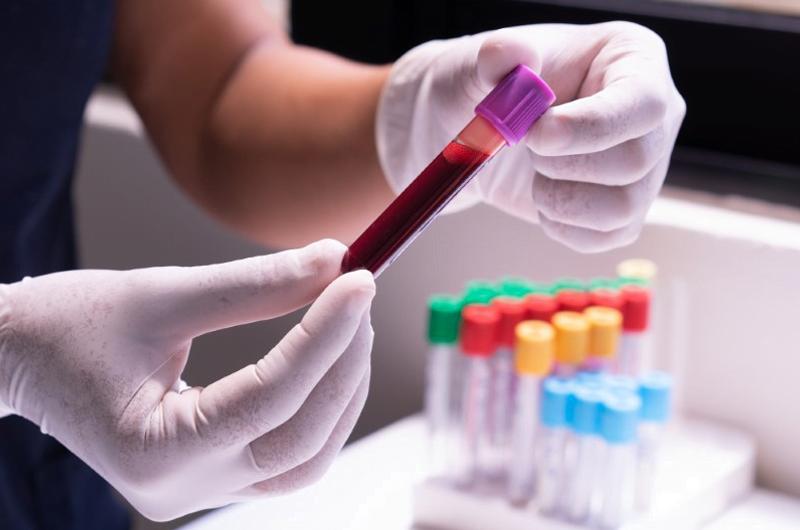 Wyniki badań laboratoryjnych a płyny