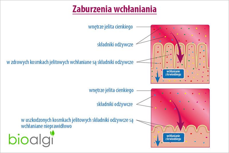Znaczenie wczesnej diagnozy