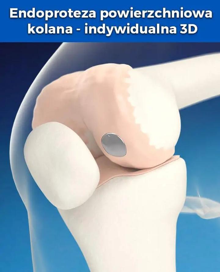 Zrozumienie procesu leczenia chirurgicznego