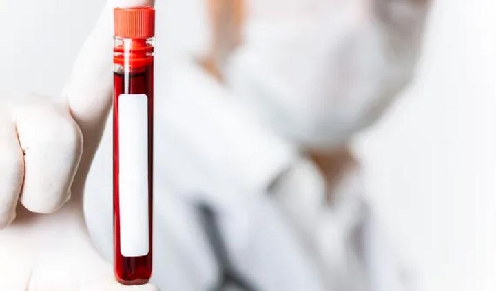 Przygotowanie do badania krwi