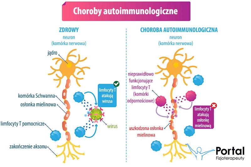 Choroby autoimmunologiczne
