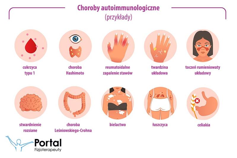 Choroby immunologiczne