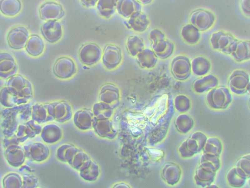 Diagnostyka a jakość życia