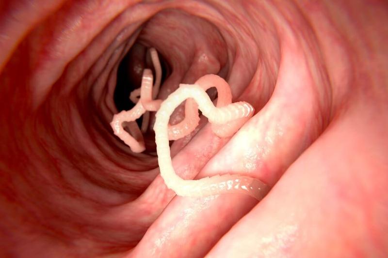 Profilaktyka i higiena przeciw robakom