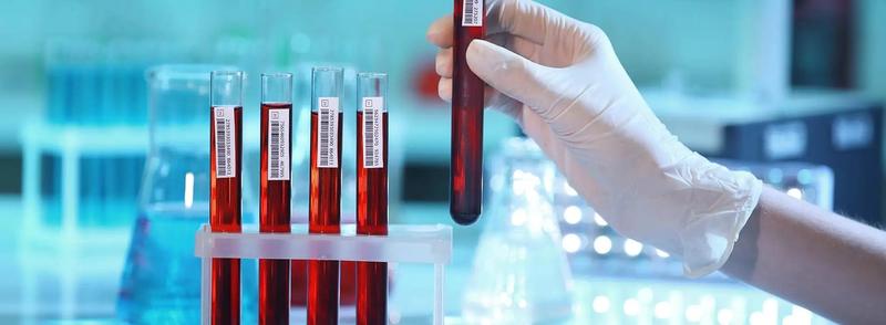 Przygotowanie do badań laboratoryjnych