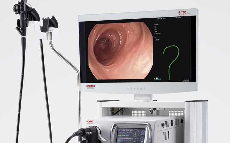 Przygotowanie do kolonoskopii