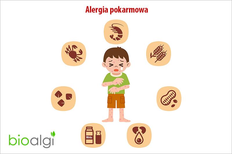 Testy diagnostyczne alergii pokarmowych