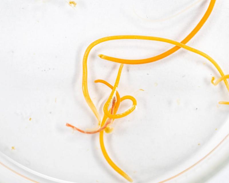 Wykrywanie pasożytów jelitowych