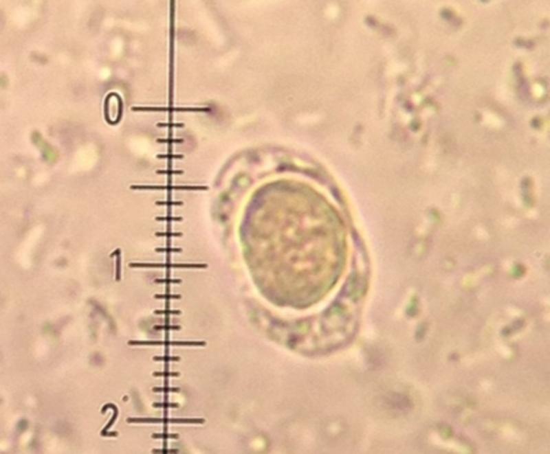 Blastocystis hominis – co powinieneś wiedzieć o objawach i naturalnych metodach leczenia