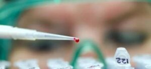 Czy badanie żywej kropli krwi to klucz do lepszego zdrowia? Sprawdź, czy warto je wykonać!