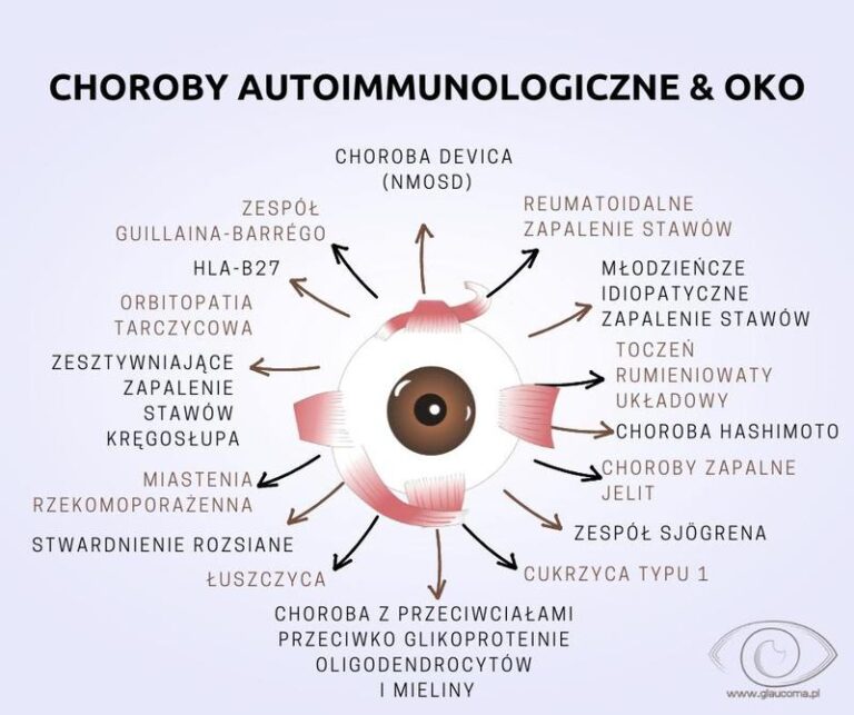Odkrywamy choroby immunologiczne: które schorzenia należą do tej grupy?