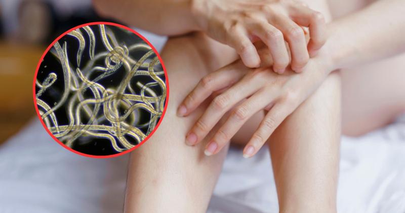 Objawy pasożytów u człowieka