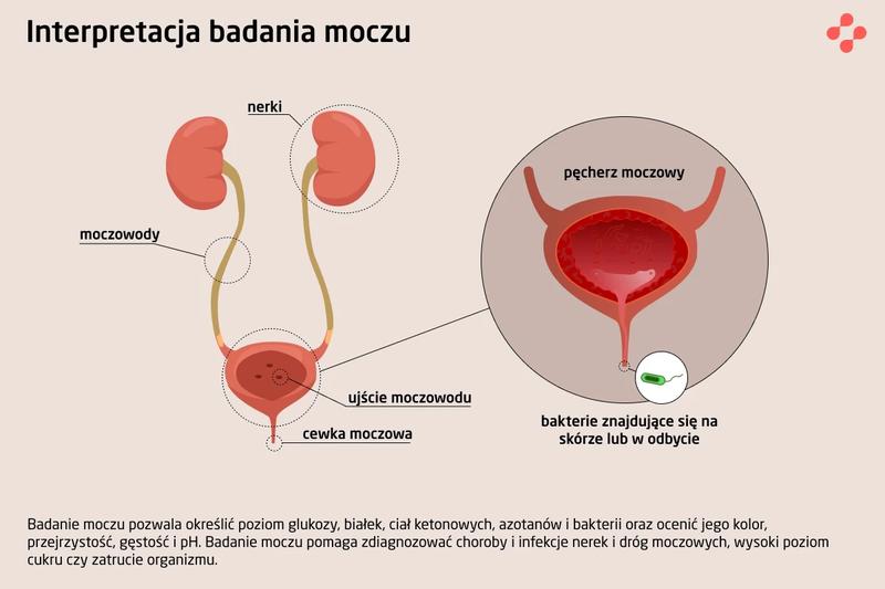 Pieczenie i ból przy oddawaniu moczu